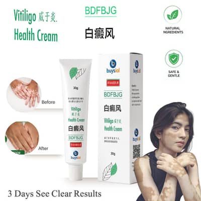 Vitiligo Cream-Skin Pigmentation Care, Gentle & Easy to Use
