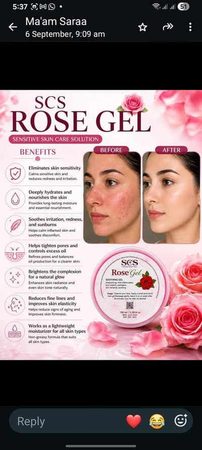 rose gel