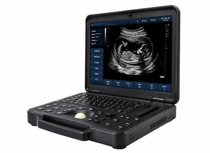 M VOLTA NOTEPAD DIGITAL AMRICAN. LATEST 2027 MODEL ULTRASOUND MACHINE