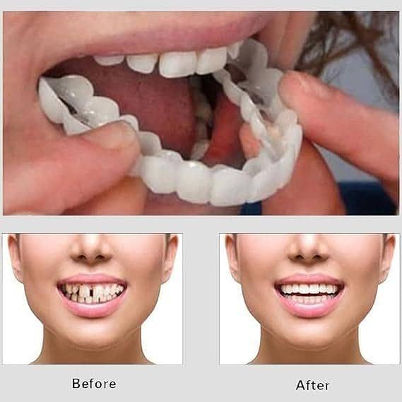 Snap on Smile Teeth - Hismile Smile Teeth Cover, Teether, Teeth Whitening Strips, Teeth Whitening Product, Braces for Teeth Steel, and Teeth Cover Cap Plastic