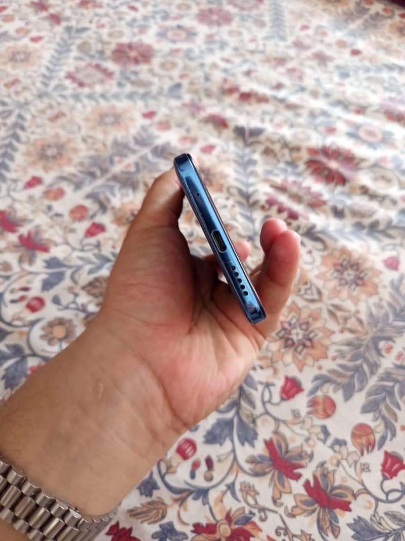 Xiaomi Redmi Note 11 4