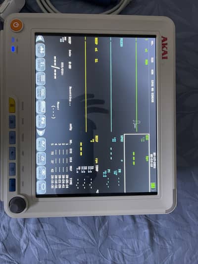 Cardiac monitor
