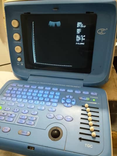 ultrasound machine