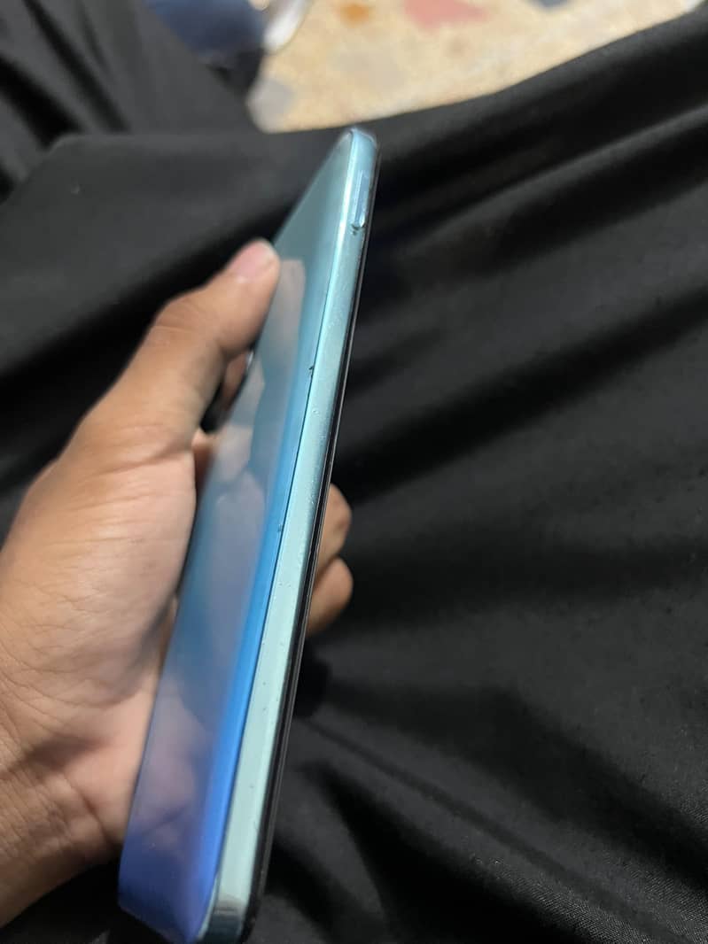 Xiaomi Redmi Note 11 3