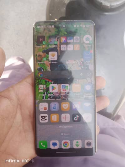 Honor X9b