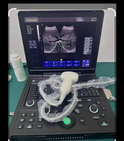 oriel notebook ultrasound machine