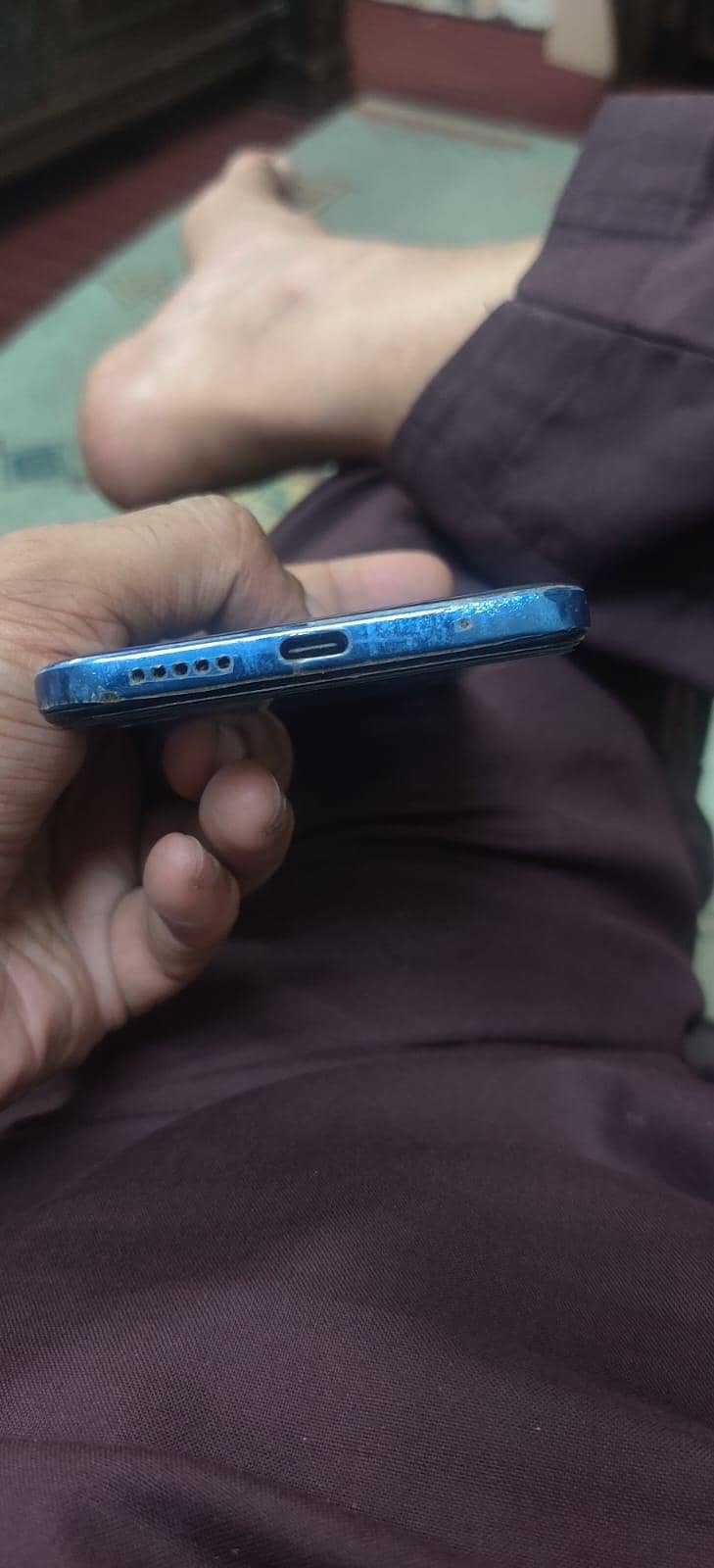 Xiaomi Redmi Note 11 6