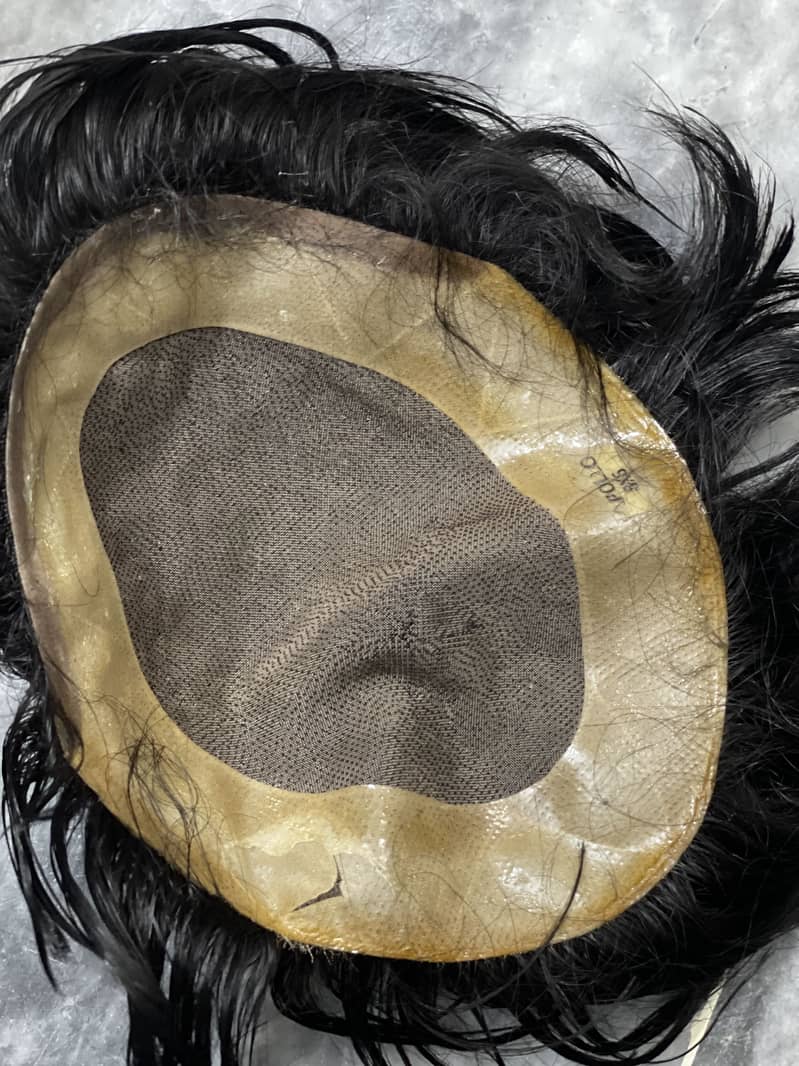 hair patch 1