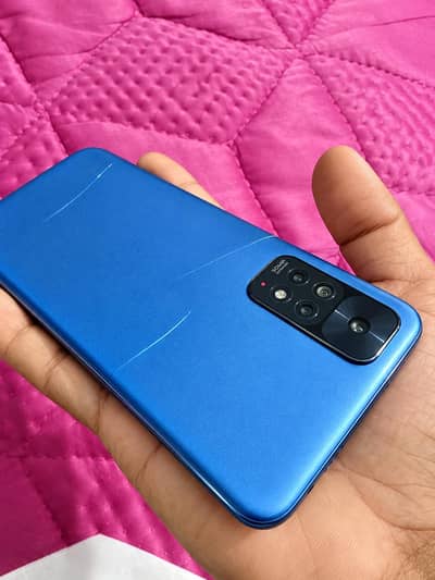 redmi note 11 /6/128 exchange