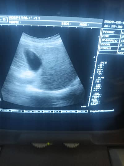 Portable ultrasound machine ( just like new )