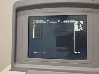 ultrasound  machine Biocare BU 907 few months  used