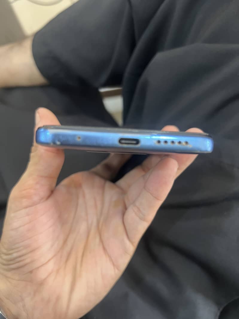 Xiaomi Redmi Note 11 1