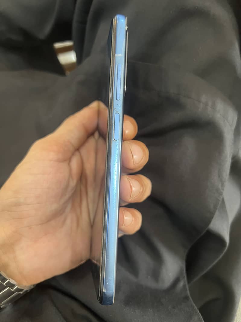 Xiaomi Redmi Note 11 4