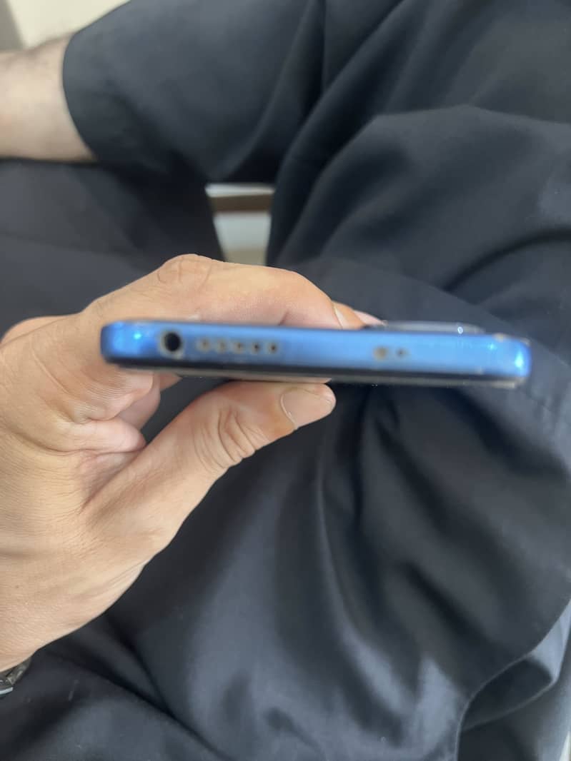 Xiaomi Redmi Note 11 6