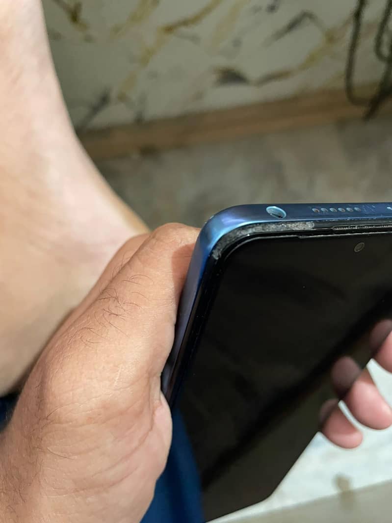 Xiaomi Redmi Note 11 Pro 6