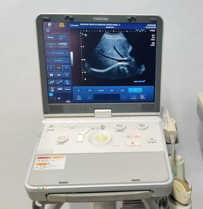Used Chinese and Japanes Ultrasound machines , Colour Dopplers