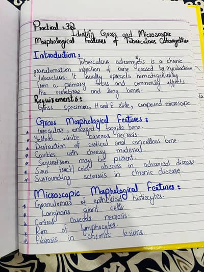 assignment writing