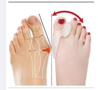 1 pair Silicone Toe Finger Separator, Corrector For Big Finger - Bunion Pedicure Silicon Gel Foot Protector Care  r5799