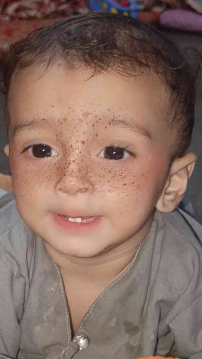 ABUZAR 