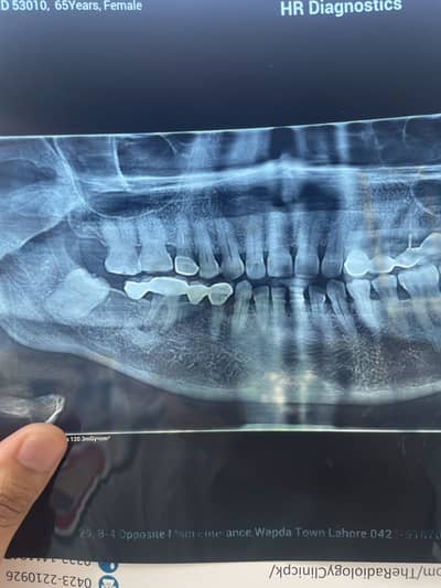 Dental Assistant