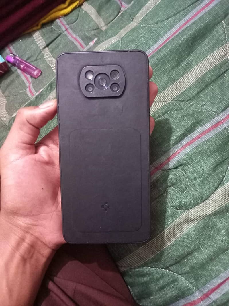 Poco x3 1