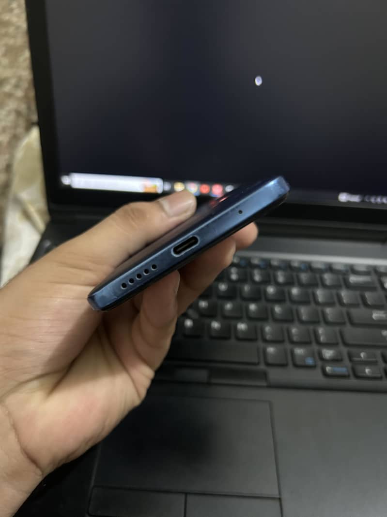 Xiaomi Redmi Note 11 1