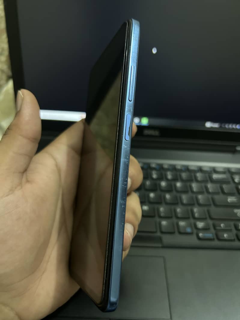 Xiaomi Redmi Note 11 2