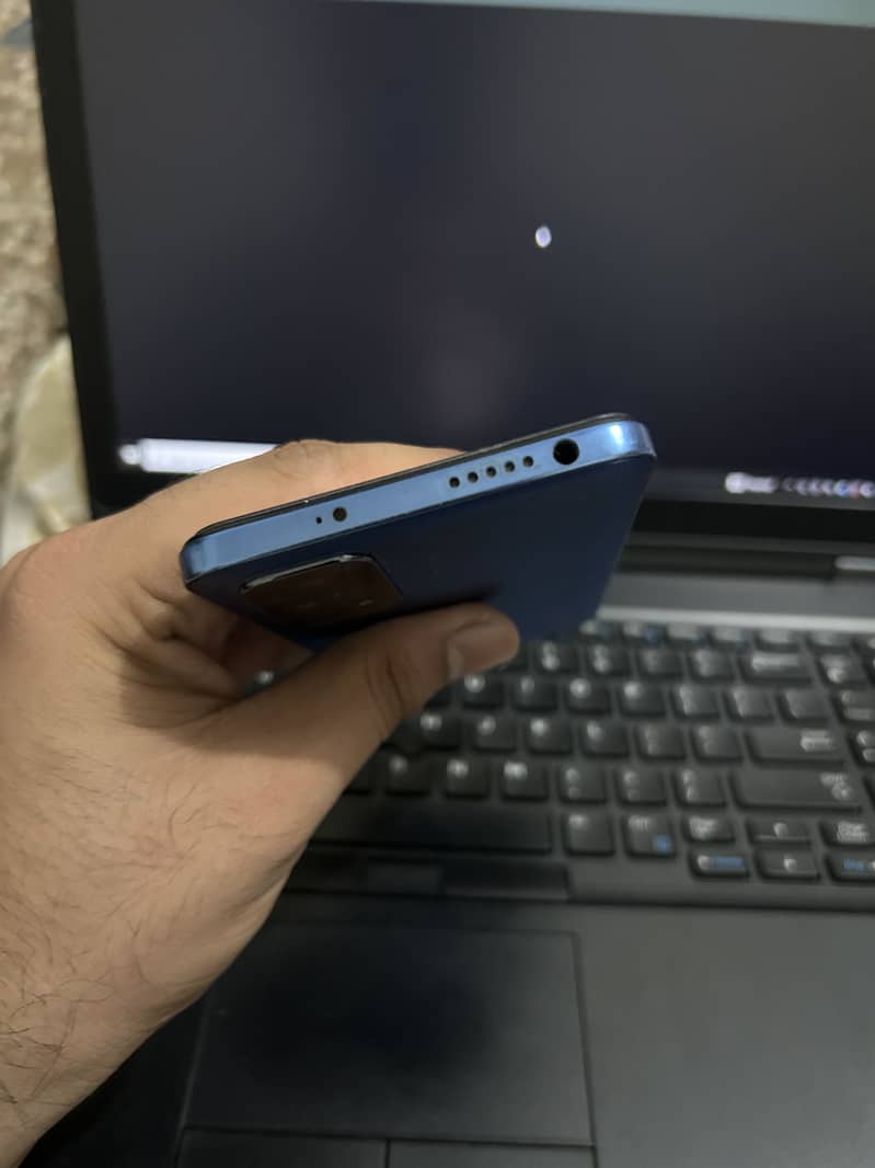 Xiaomi Redmi Note 11 3