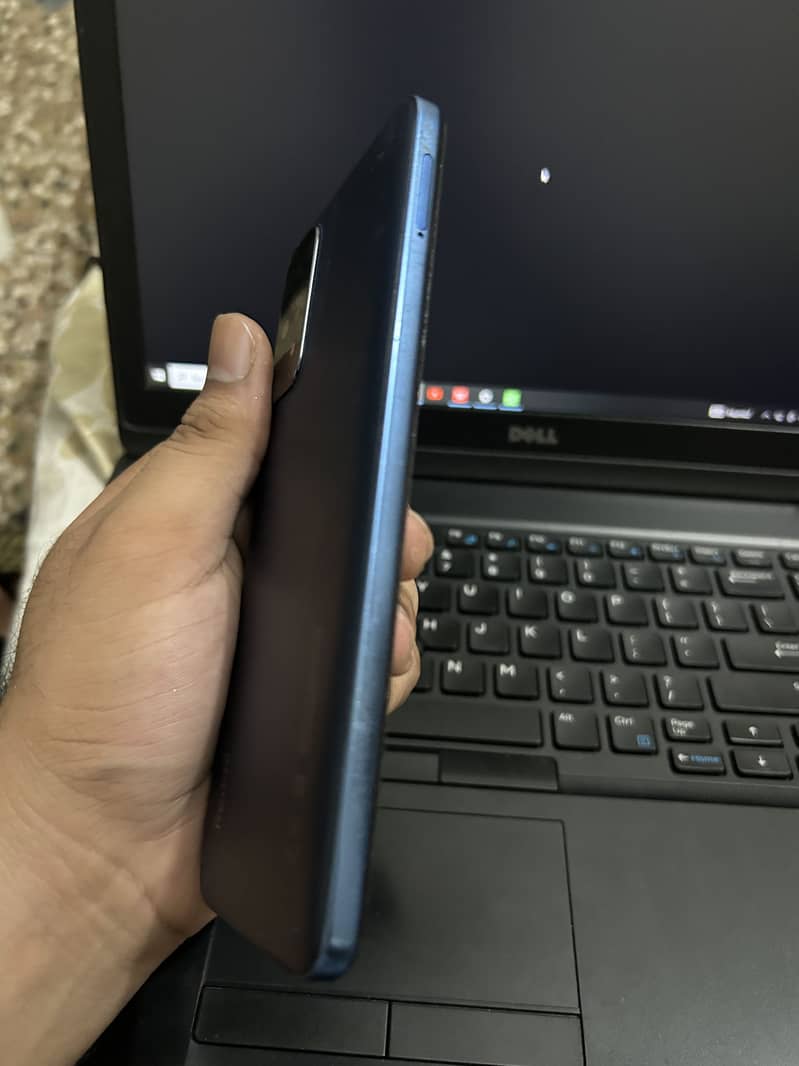 Xiaomi Redmi Note 11 6