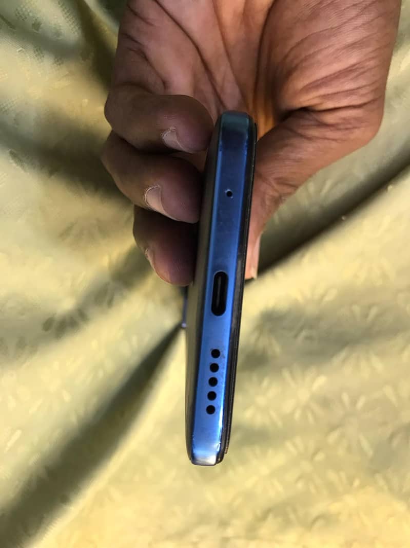 Xiaomi Redmi Note 11 6