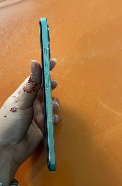 Xiaomi Redmi Note 12