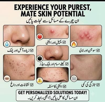 Acne Pimples & Dark Spot Skin Care Treatment_Personalised Solution