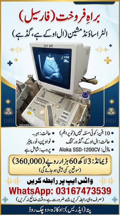 Aloka SSD-1200CV Ultrasound Machine for Sale – All OK Condition