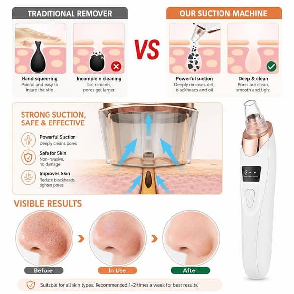 T  5-in-1 Electric Blackhead Remover Vacuum – Rechargeable Facial Pore Cleaner with Suction Technology | Acne & Whitehead Removal Device for Deep Skin Cleansing, Blackhead Extraction & Face Care