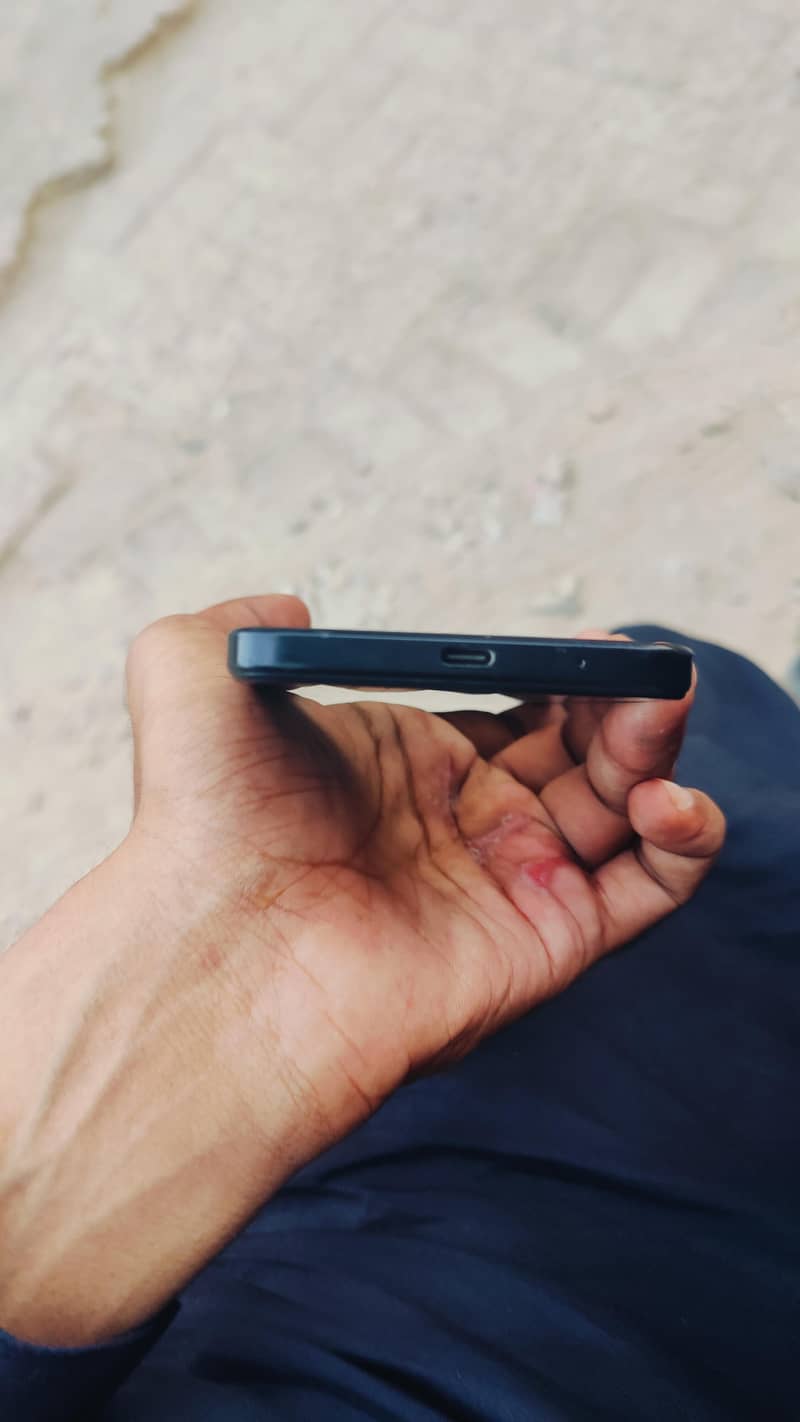 Xiaomi Redmi A3 7