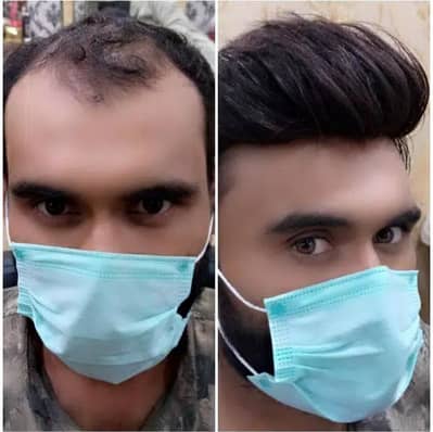 haur patch hair units for karachi