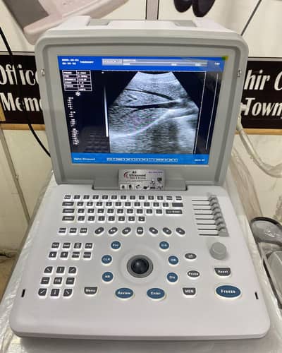 Slightly Used APOLLO 7 Portable Digital Ultrasound Machine