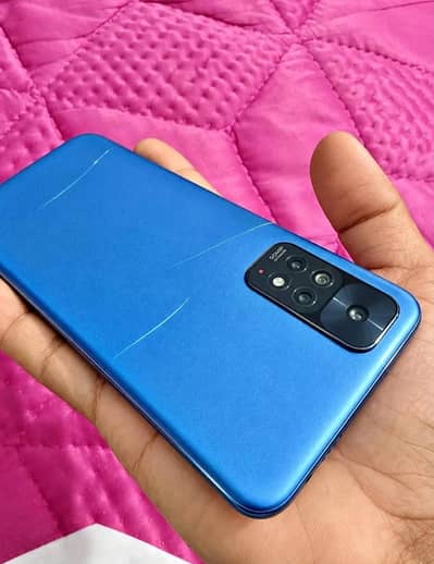 redmi note 11 6+2/128 exchange