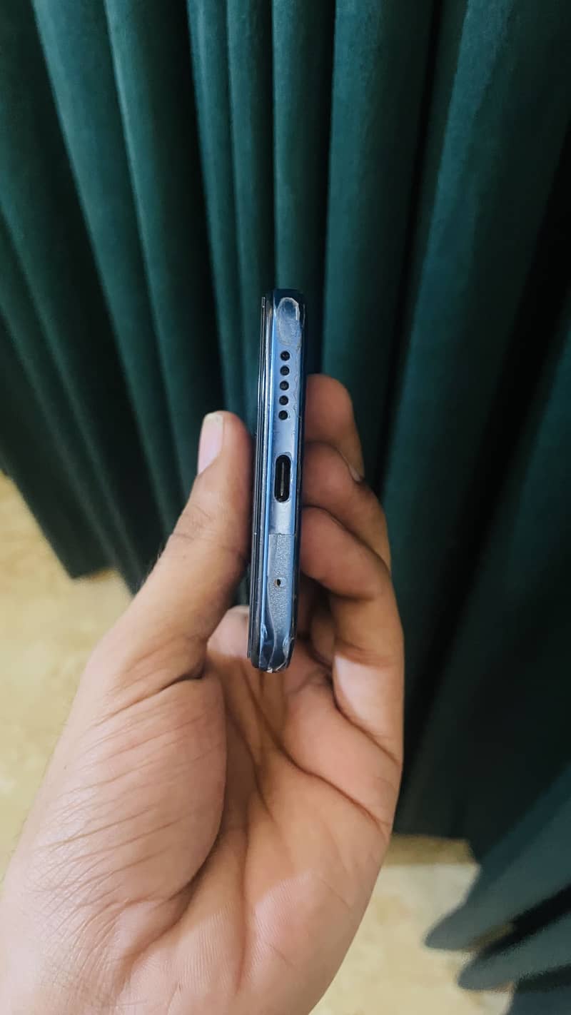Xiaomi Redmi Note 11 5