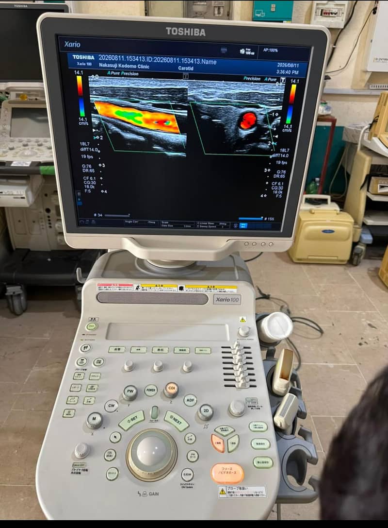 Used & New Ultrasound Machines - Ultrasound Machines - 1120041892