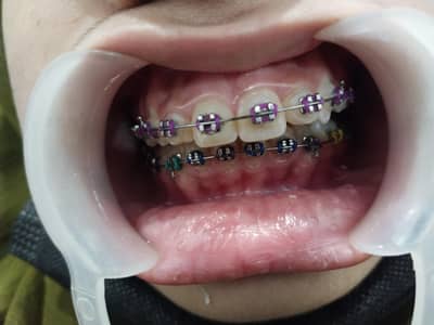 Female dental surgeon required
