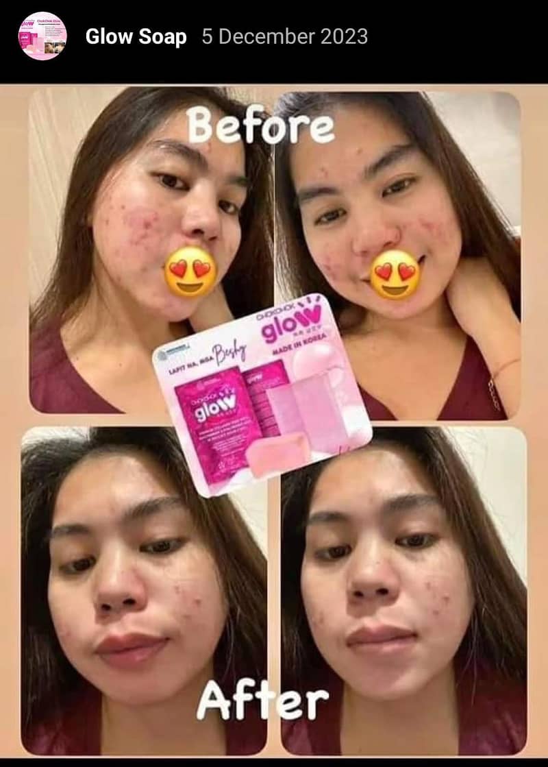 glow soap avlibale 03150403302 0