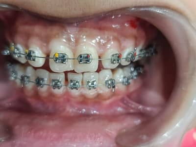 dental hygienist 10year experience