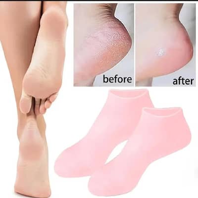 CRACKED HEEL GEL SOCKS