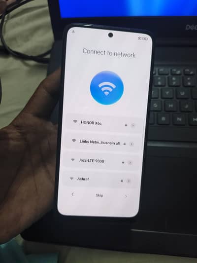 redme note 11