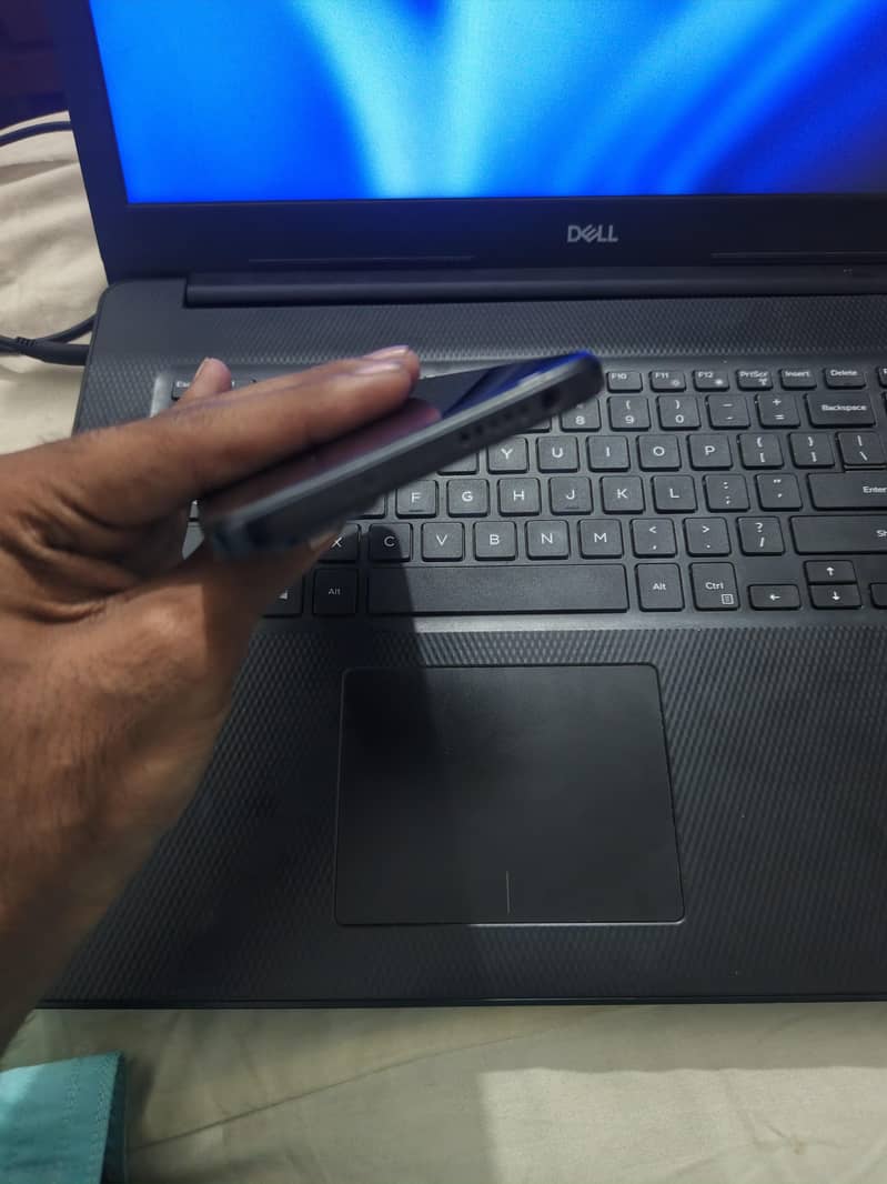 redme note 11 3