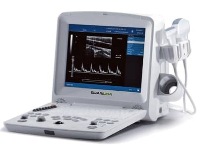 EDAN DUS 60 – Portable Digital Ultrasound