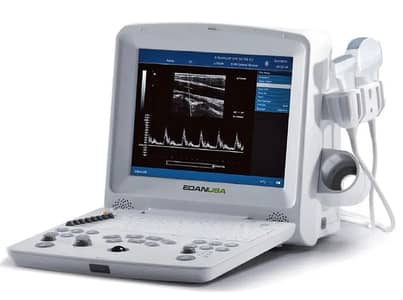 EDAN DUS 60 – Portable Digital Ultrasound machine & PW Doppler
