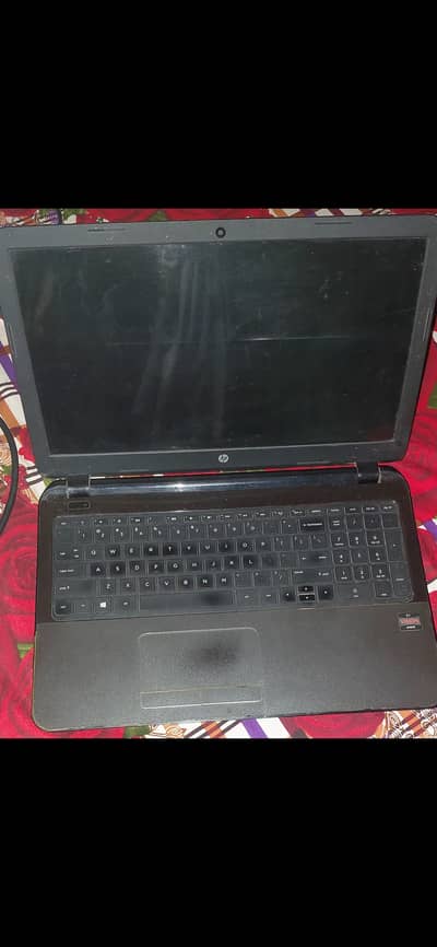 Hp vision E1