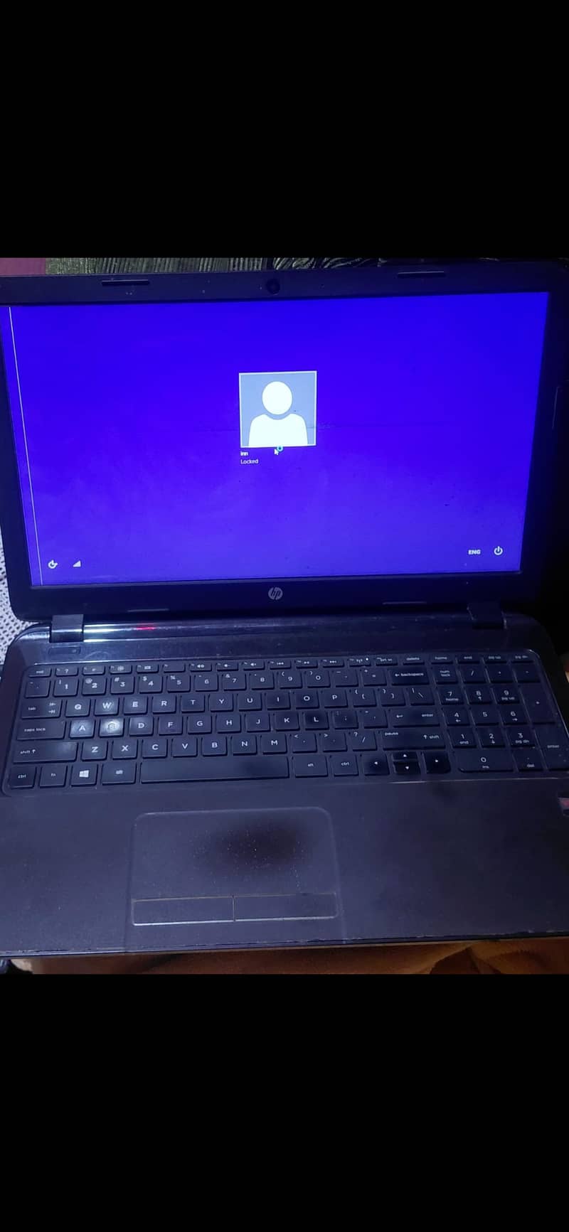 Hp vision E1 3